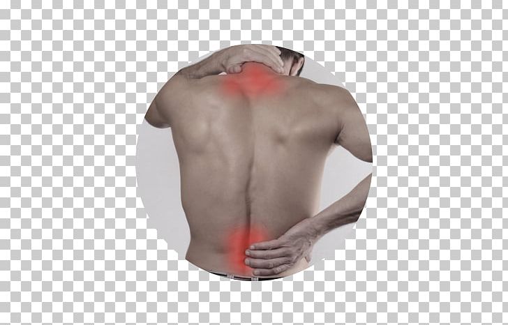 Massage Physical Therapy Chiropractic Neck Pain PNG, Clipart, Ache, Arm, Athlete, Back, Back Pain Free PNG Download