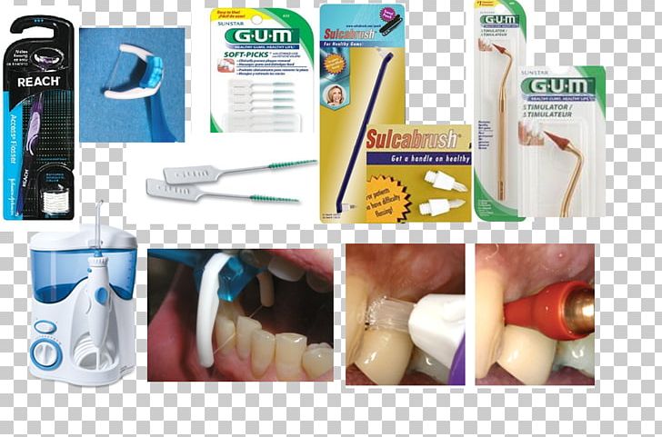 Toothbrush Dental Floss Dental Water Jets Toothpick Dentistry PNG, Clipart, Bridge, Brush, Dental Braces, Dental Floss, Dental Water Jets Free PNG Download