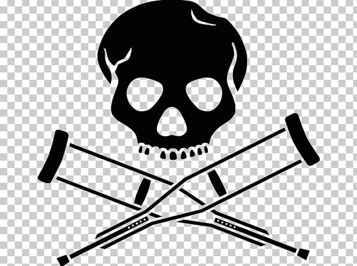 Logo MTV Jackass PNG, Clipart, Angle, Art Print, Black, Black And White, Bone Free PNG Download