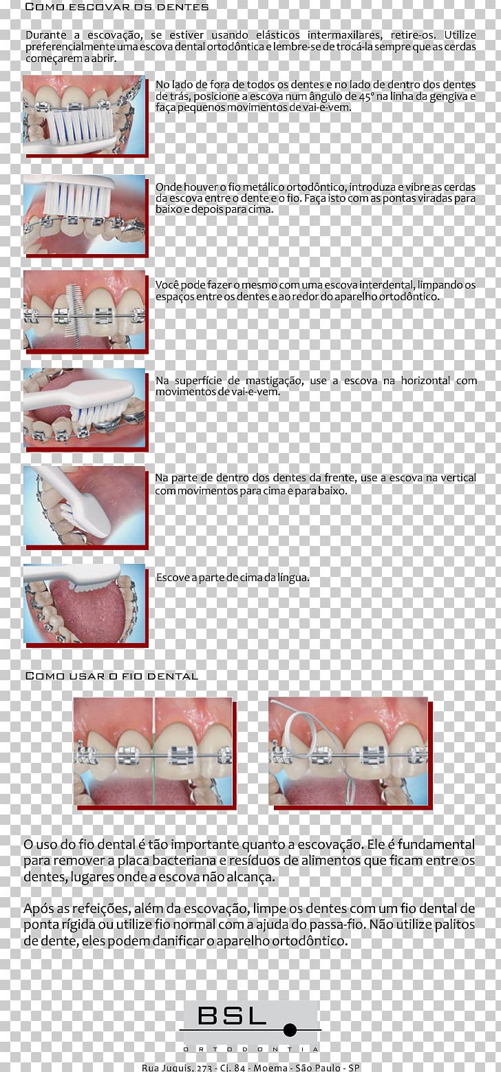 BSL Ortodontia Ltda Moema Paper Jaw Orthodontics PNG, Clipart, Brush, Clinic, Human Tooth, Jaw, Line Free PNG Download