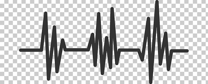 Heart Rate Pulse Drawing PNG, Clipart, Angle, Art Museum, Background, Beat, Black And White Free PNG Download