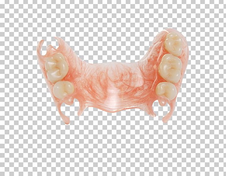 Deflex Tooth Empresa Virodent System PNG, Clipart, Americas, Argentina, Buenos Aires, Dental Implant, Empresa Free PNG Download