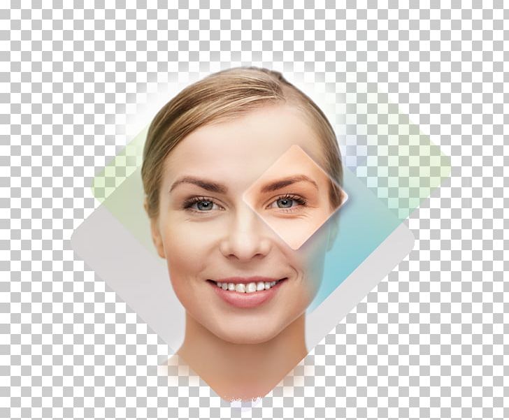 Acne Skin Face Dermatology Surgery PNG, Clipart, Acne, Acne Fulminans, Cheek, Chin, Dermatology Free PNG Download