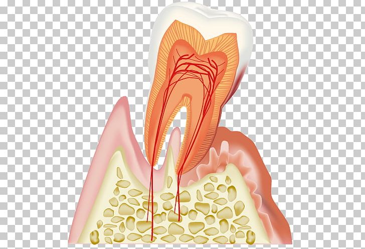Dentistry Periodontal Disease 歯科 Gums PNG, Clipart, Ache, Dental Surgery, Dentist, Dentistry, Dentures Free PNG Download