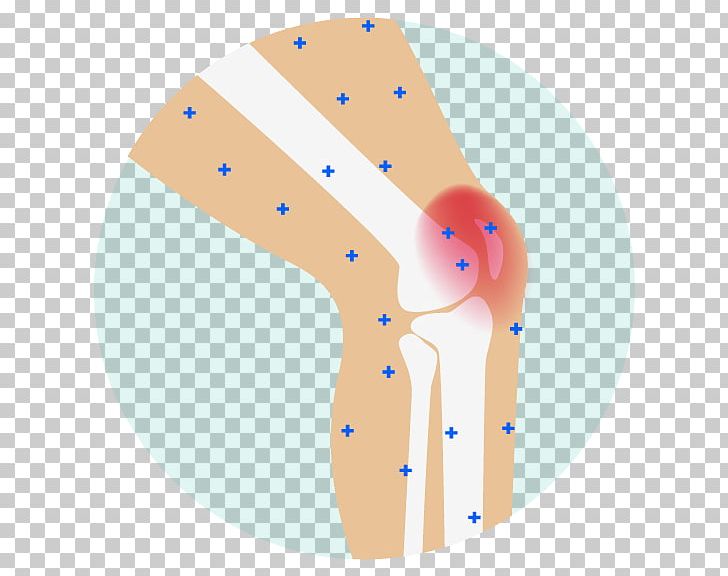 Pain Management Analgesic Joint Pain Arthritis Back Pain PNG, Clipart, Ache, Analgesic, Arm, Arthritis, Back Pain Free PNG Download