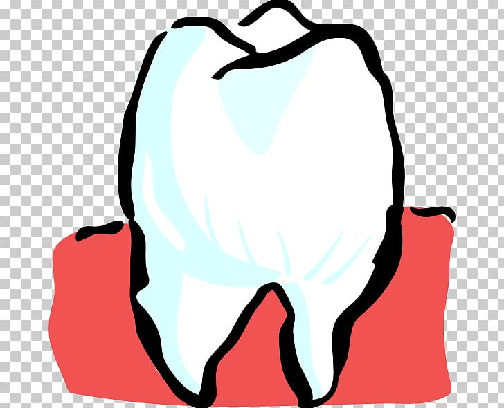 Wisdom Tooth Dentistry PNG, Clipart, Artwork, Black, Black And White, Dental Extraction, Dentist Free PNG Download