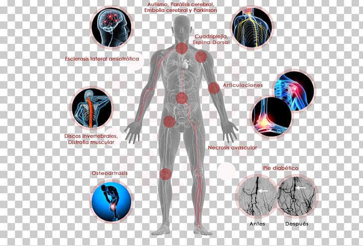Stem Cell Stem-cell Therapy Human Body PNG, Clipart, Arm, Ball, Body, Bone Marrow, Cell Free PNG Download