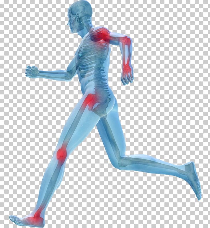 Sports Injury Physical Therapy Sports Medicine PNG, Clipart, Arm, Arthritis, Back Pain, Figurine, Health Care Free PNG Download