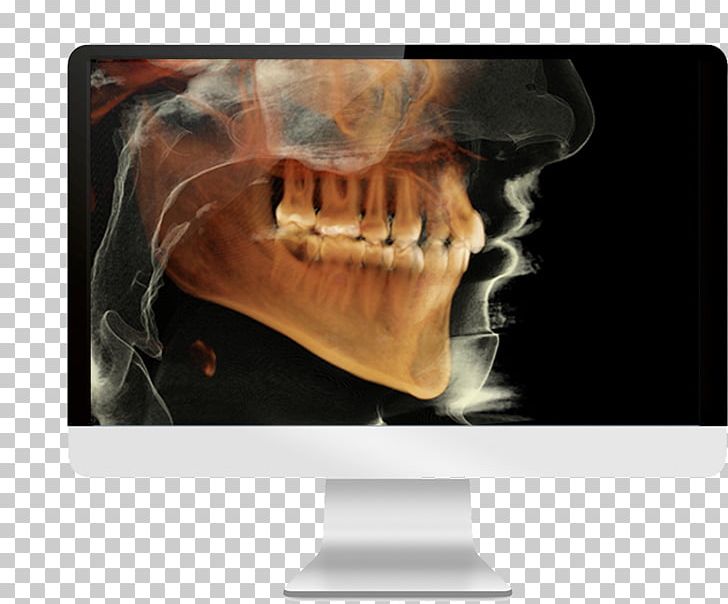 Cone Beam Computed Tomography Dental Radiography Dentistry PNG, Clipart, Bone, Brand, Computed Tomography, Cone Beam Computed Tomography, Dental Radiography Free PNG Download