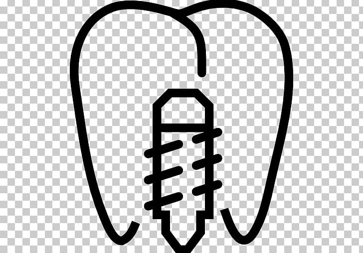 Cosmetic Dentistry Dental Implant Dental Surgery PNG, Clipart, Allon4, Area, Black And White, Brand, Bridge Free PNG Download