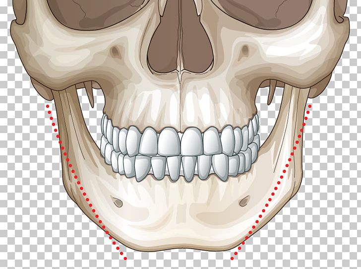 Surgery Intervenție Chirurgicală Face Mandible Chin PNG, Clipart, Bone, Chin, Ear, Face, Hospital Free PNG Download
