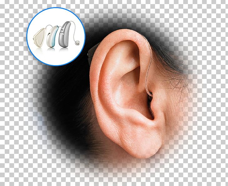 Hearing Aid Audiology Hearing Test PNG, Clipart, Audiologist, Audiology, Chin, Closeup, Ear Free PNG Download