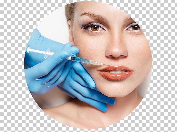 Plastic Surgery Botulinum Toxin Medicine Surgeon PNG, Clipart, Beauty, Botulinum Toxin, Cheek, Chin, Cosmetics Free PNG Download
