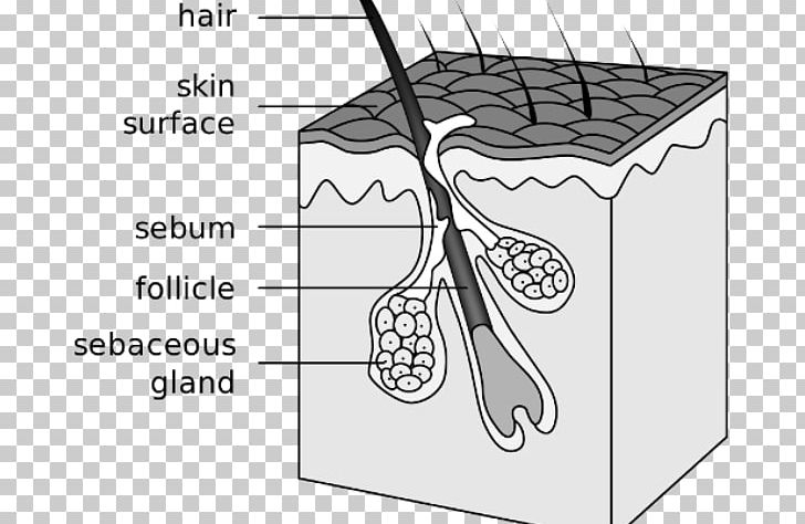 Hair Follicle Sebaceous Gland Acne Canities Integumentary System PNG, Clipart, Acne, Angle, Area, Black And White, Cancer Free PNG Download