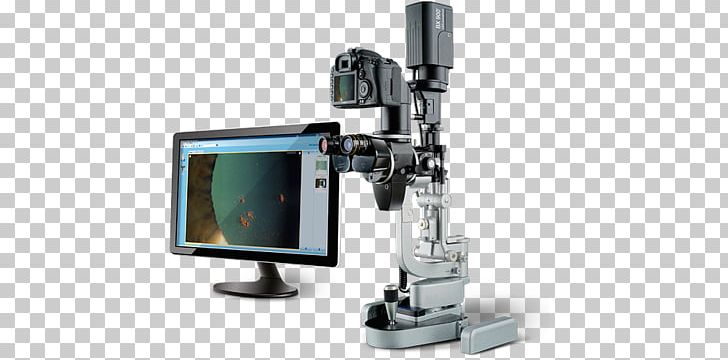Biomedix Optotechnik & Devices Private Limited Microscope Slit Lamp Ophthalmology Optics PNG, Clipart, Angle, Camera Accessory, Computer Monitor Accessory, Diagnose, Eye Free PNG Download