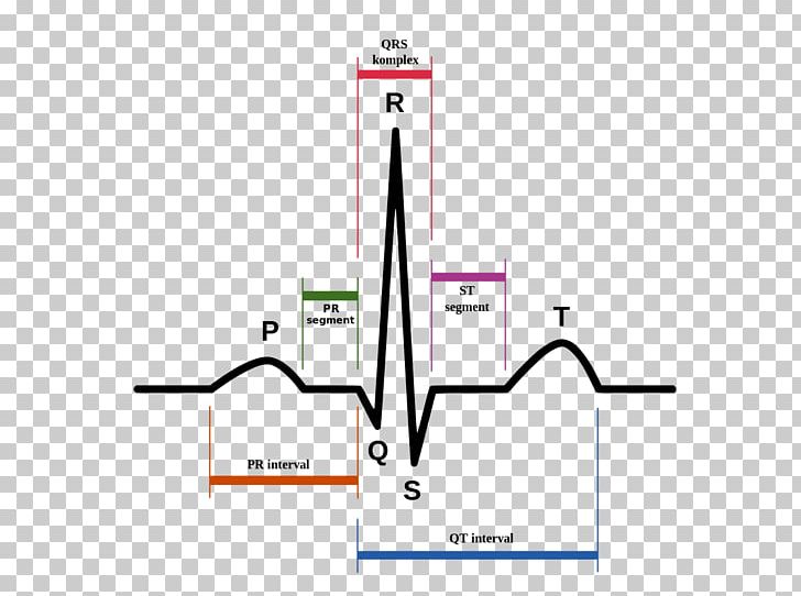 Electrocardiography Heart Sinus Rhythm QRS Complex Cardiac Arrest PNG, Clipart, Angle, Area, Atrium, Brand, Cardiac Cycle Free PNG Download