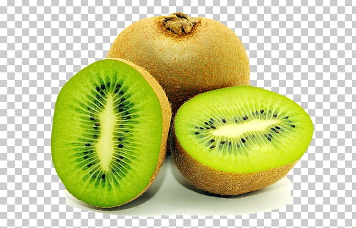 Kiwifruit Food PhotoScape PNG, Clipart, Apple, Diet Food, Food, Fruit, Galia Free PNG Download