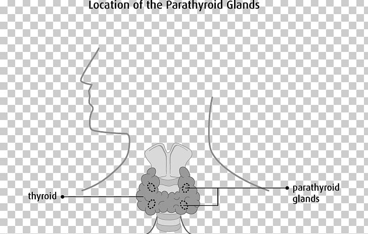 Parathyroid Gland Endocrine Gland Thyroid Disease Cancer PNG, Clipart, Angle, Arm, Brand, Cartoon, Cell Free PNG Download
