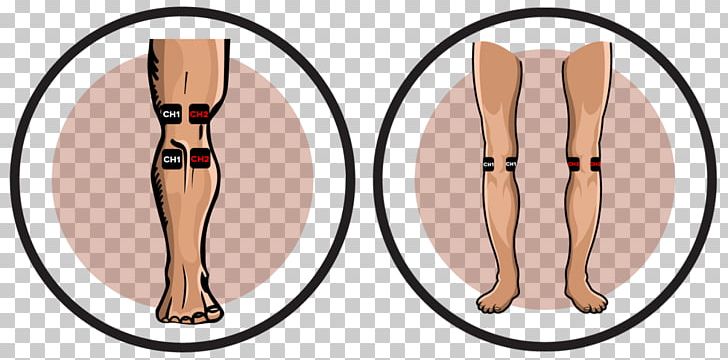 Knee Pain Transcutaneous Electrical Nerve Stimulation Electrode Electrical Muscle Stimulation PNG, Clipart, Ache, Arm, Ear, Electrical Muscle Stimulation, Electrode Free PNG Download