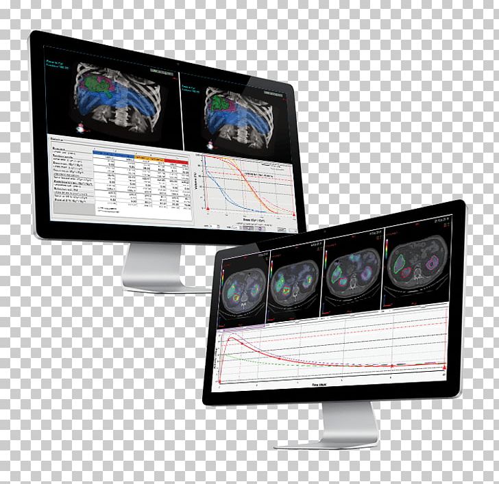Nuclear Medicine Dosisoft Dosimetry Radiation Therapy PNG, Clipart, Brand, Communication, Computer Software, Disease, Display Device Free PNG Download