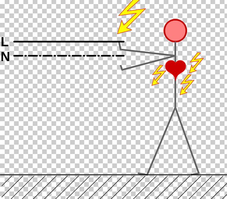 Electrical Injury Electric Current Diagram PNG, Clipart, Accident, Ampere, Angle, Area, Diagram Free PNG Download
