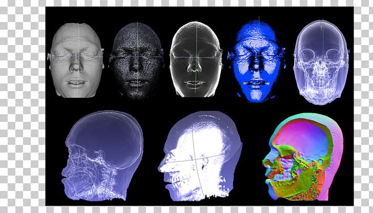 Computed Tomography Skull X-ray Organism PNG, Clipart, Bone, Brain, Computed Tomography, Eye Tracking, Fantasy Free PNG Download