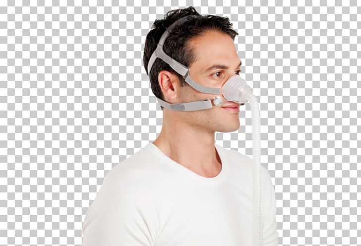 Continuous Positive Airway Pressure Mask ResMed Patient PNG, Clipart, Apnea, Art, Artificial Ventilation, Cheek, Chin Free PNG Download