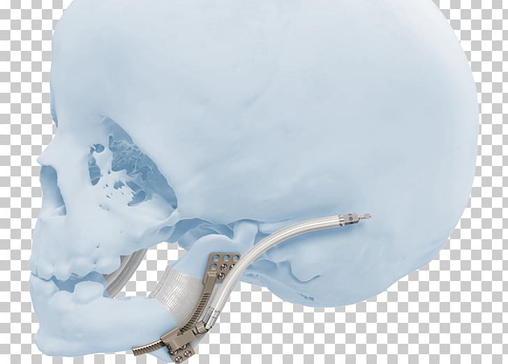 Skull Product Design Ice PNG, Clipart, Bone, Fantasy, Ice, Jaw, Joint Free PNG Download
