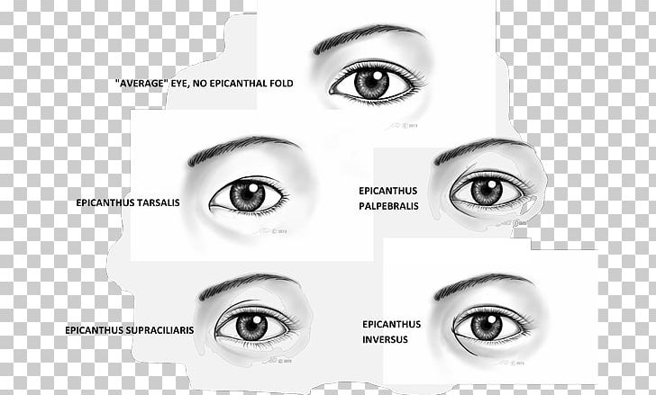 Epicanthic Fold Canthus Eyebrow Ophthalmology PNG, Clipart,  Free PNG Download