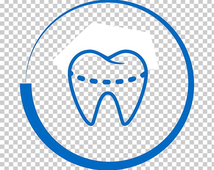 Dentistry Bridge Dental Implant Human Tooth PNG, Clipart, Angle, Area, Blue, Bridge, Cosmetic Dentistry Free PNG Download