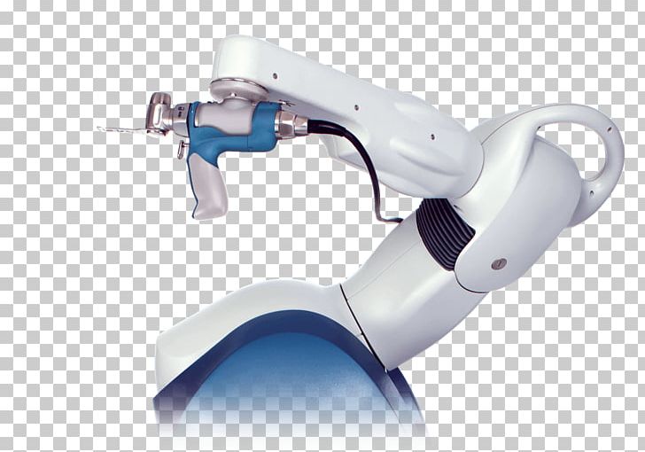 Knee Replacement Hip Replacement Joint Replacement Robot-assisted Surgery PNG, Clipart, Computerassisted Surgery, Fantasy, Hardware, Hip, Hip Replacement Free PNG Download