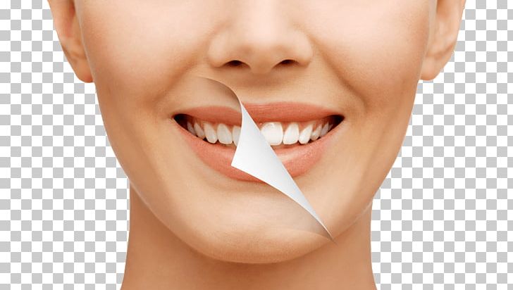 Freedom Dental Cosmetic Dentistry Makeover PNG, Clipart, Chin, Closeup, Cosmetic Dentistry, Dental Implant, Dental Public Health Free PNG Download