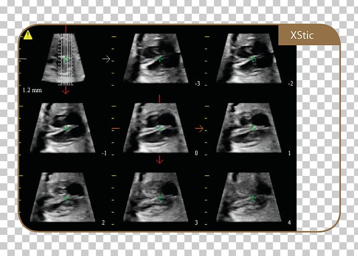 Ultrasonography TWICE Medical Equipment Medicine Magnetic Resonance Imaging PNG, Clipart, Academisch Ziekenhuis, Brand, Camera, Dbox Technologies Inc, High Tech Free PNG Download