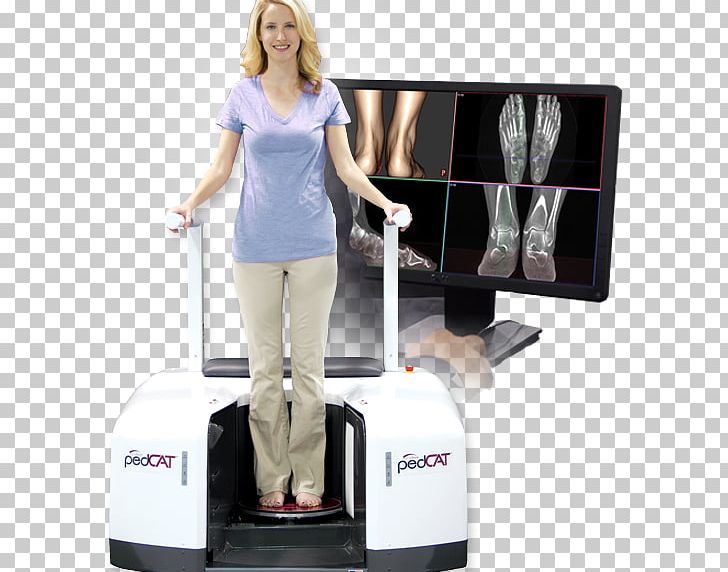 Cone Beam Computed Tomography Weight-bearing Podiatrist X-ray PNG, Clipart, Ankle, Computed Tomography, Cone Beam Computed Tomography, Foot, Foot And Ankle Surgery Free PNG Download