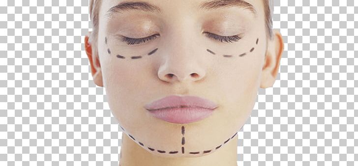 Plastic Surgery La Chirurgie Esthétique Aesthetic Medicine PNG, Clipart, Aesthetic Medicine, Aesthetics, Beauty, Botulinum Toxin, Breast Surgery Free PNG Download