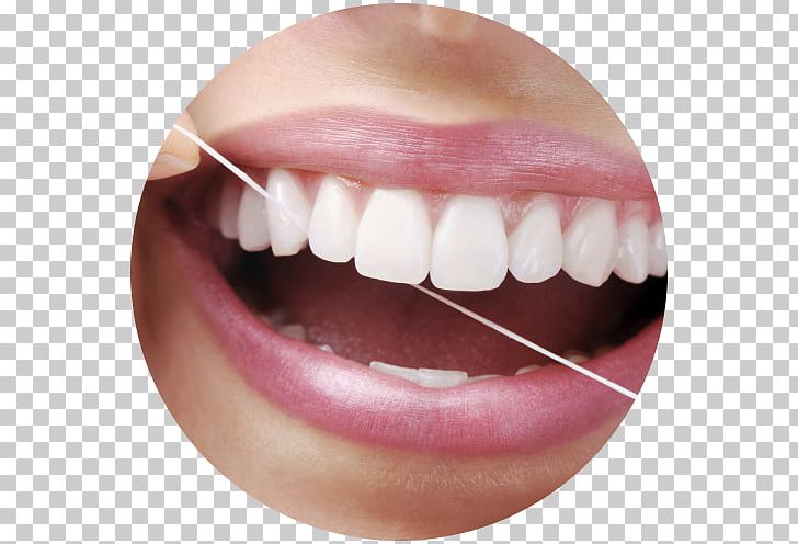 Dental Floss Periodontal Disease Dentistry Human Tooth PNG, Clipart, Chin, Closeup, Cosmetic Dentistry, Dental, Dental Floss Free PNG Download