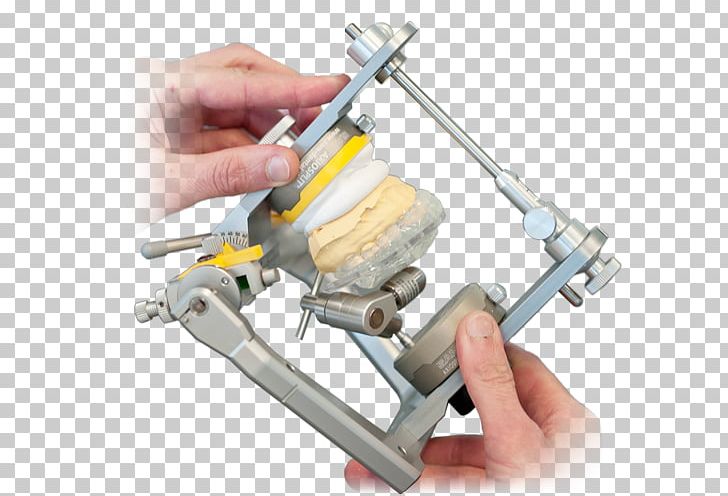 Articulator Gesichtsbogen Dentistry Dental Technician SAM Präzisionstechnik GmbH PNG, Clipart,  Free PNG Download