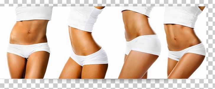 Body Contouring Cryolipolysis Liposuction Cellulite Surgery PNG, Clipart, Abdomen, Active Undergarment, Adipose Tissue, Briefs, Clinic Free PNG Download