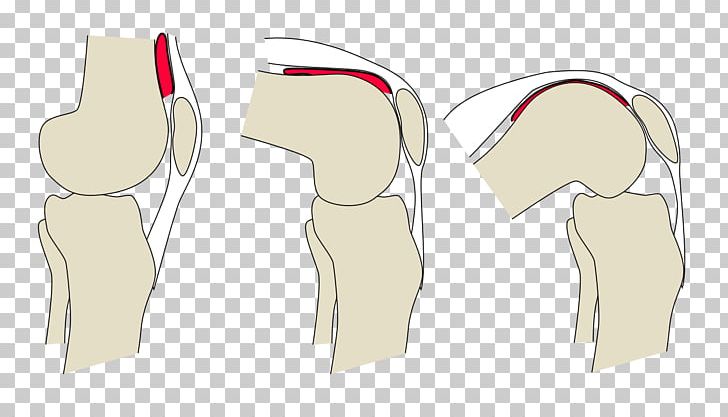 Articular Capsule Of The Knee Joint Synovial Joint Joint Capsule PNG, Clipart, Anatomy, Angle, Anterior Cruciate Ligament, Arm, Fibrous Joint Free PNG Download