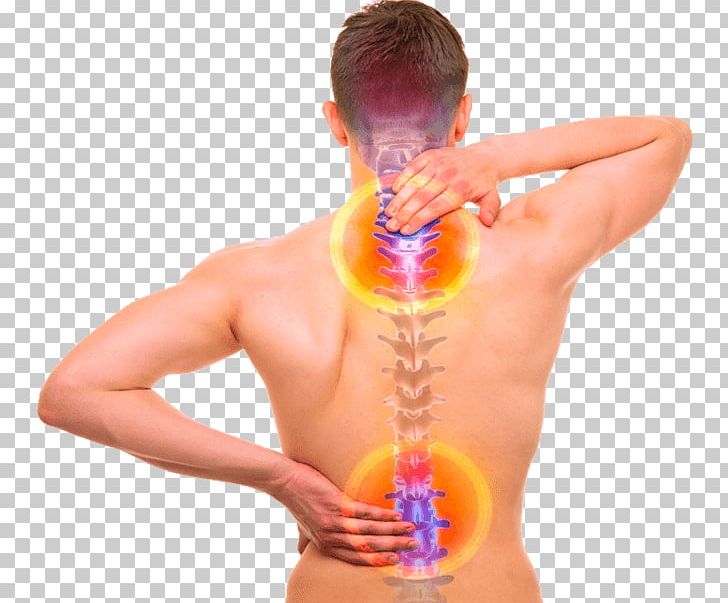 Back Pain Vertebral Column Human Back Human Body Bone PNG, Clipart, Abdomen, Ache, Arm, Back Injury, Back Pain Free PNG Download