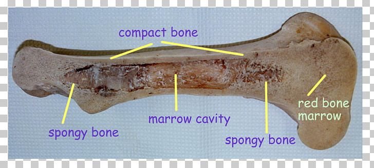 Bone Marrow Color Yellow Purple PNG, Clipart, Bone, Bone Marrow, Cattle, Color, Enzyme Free PNG Download