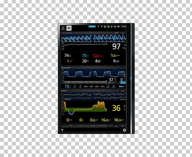 Display Device Masimo Intensive Care Unit Monitoring Perioperative PNG, Clipart, Clinician, Computer Monitors, Display Device, Electronic Health Record, Electronics Free PNG Download