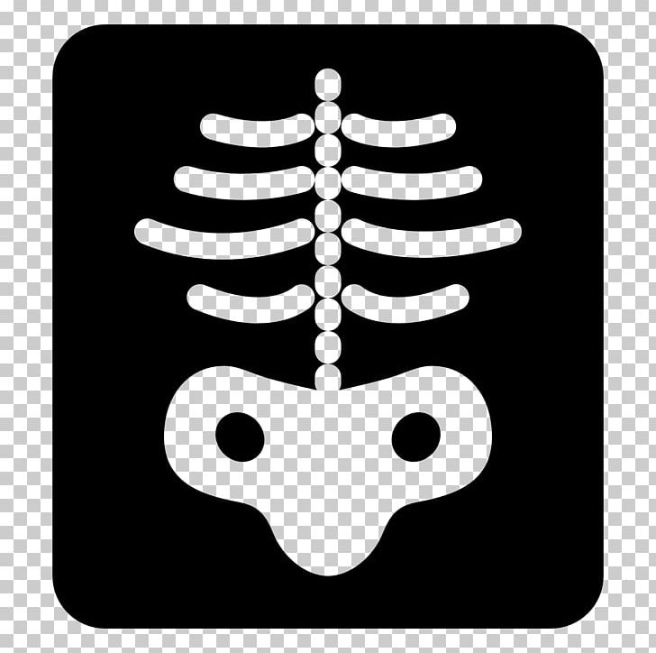 X-ray Computer Icons Health Care Medicine PNG, Clipart, Black And White, Bone, Cephalometry, Computer Icons, Digital Radiography Free PNG Download
