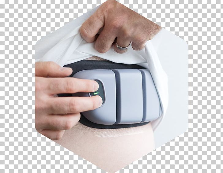 Wearable Cardioverter Defibrillator Computer Mouse Cardiac Arrest Defibrillation Implantable Cardioverter-defibrillator PNG, Clipart, Arm, Cardiac Arrest, Cardiology, Computer Mouse, Cursor Free PNG Download