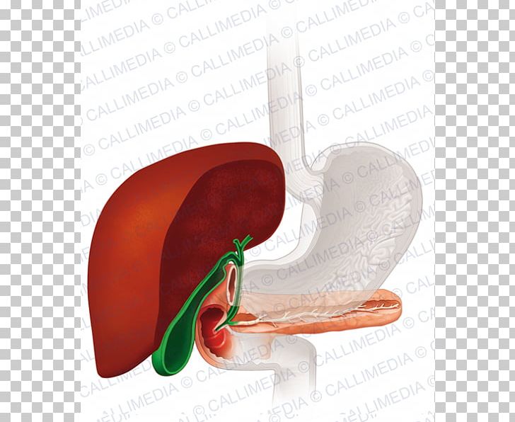 Gallbladder Gallstone Cholecystectomy Therapy Human Anatomy PNG, Clipart, Abdomen, Anatomy, Appendix, Bile, Cancer Free PNG Download