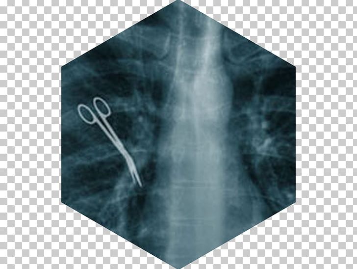 Medical Error Surgery Medicine Retained Surgical Instruments Health Care PNG, Clipart, Health Care, Hospital, Injury, Lawyer, Medical Free PNG Download