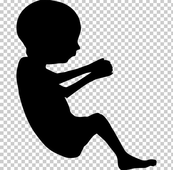 Fetus Pregnancy Infant PNG, Clipart, Abortion, Arm, Artificial Uterus, Black And White, Child Development Free PNG Download