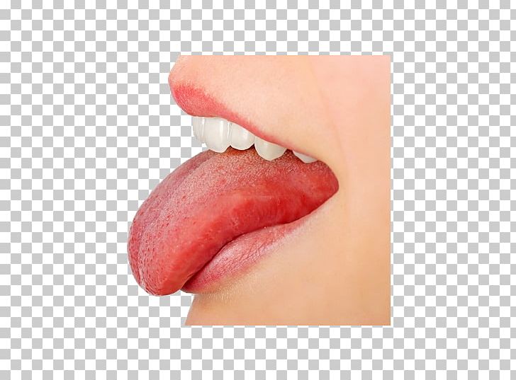 Tongue Scrapers Portable Network Graphics Canker Sore Pathology PNG, Clipart, Cheek, Chin, Closeup, Glossitis, Htc Free PNG Download