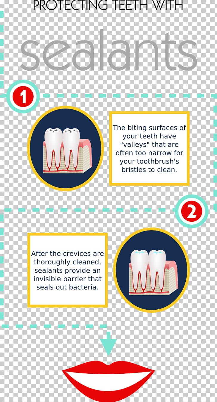 Dentistry Tooth Gums Bridge Gingivitis PNG, Clipart, Area, Brand, Bridge, Crown, Dental Floss Free PNG Download