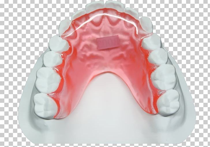 หจก.เมย์เด้นท์ Green DIALux Pink Tooth PNG, Clipart, Bottle, Color, Dentist, Email, Gmail Free PNG Download